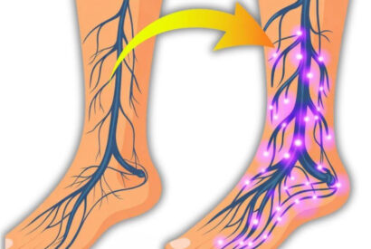 Thumbnail for 5 best drinks for peripheral neuropathy & chronic pain relief