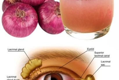 Thumbnail for Onion juice could be good for your eyes.